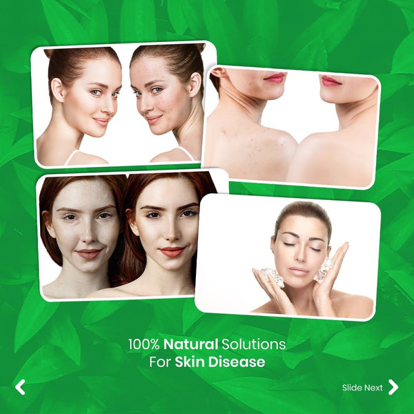 Raalon Herbal Skin Care Cream (Damar Batu) – 70g x 2