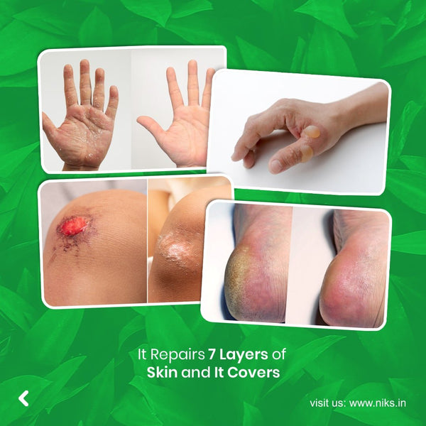 Raalon Herbal Skin Care Cream (Damar Batu) – 70g x 2